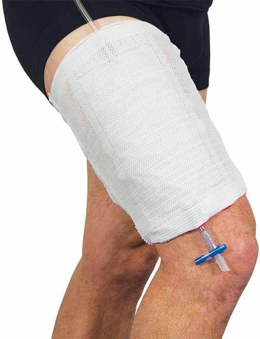 Advance® 20-36cm urine bag leg holder